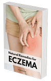 Natural Remedies for Eczema: Your Holistic Guide to Soothing Skin Naturally